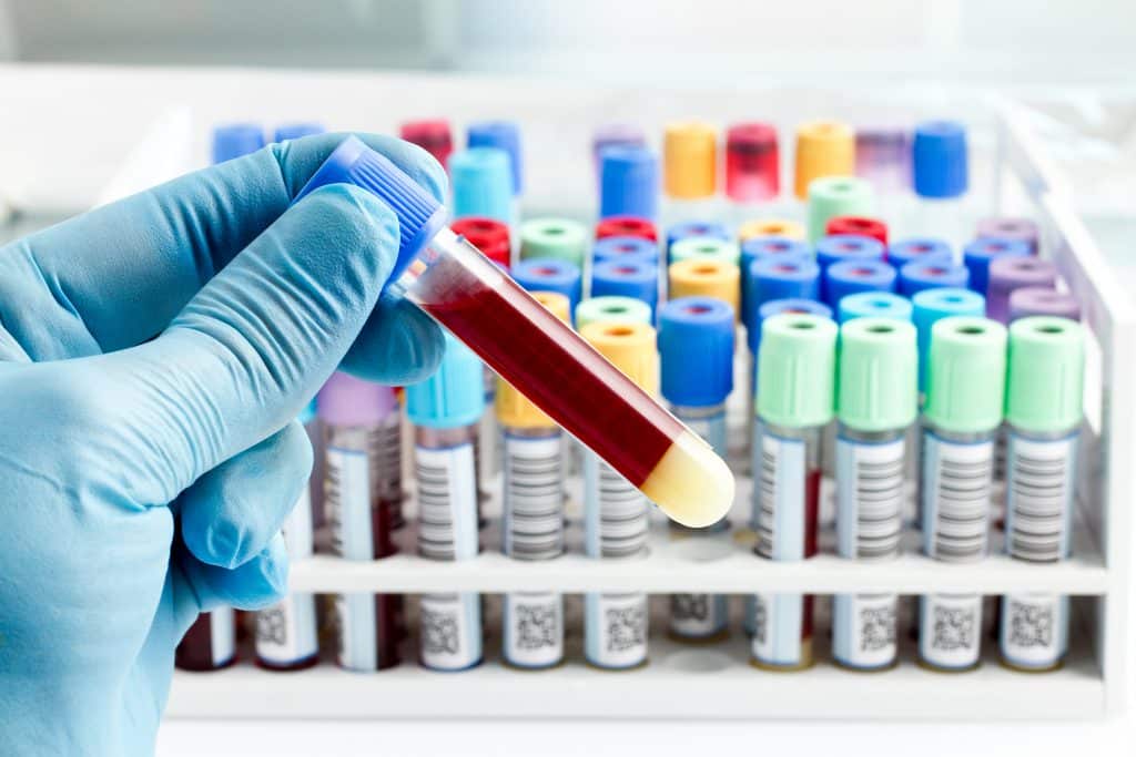 Home Draw & Mobile Phlebotomy